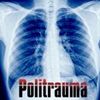 Foto de: Politrauma