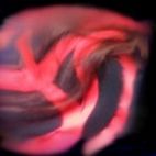 Anomalia