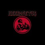 Nekrofetus