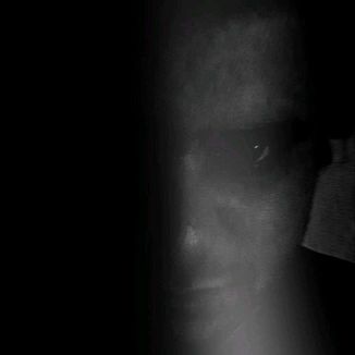 Foto da capa: Where the Wound Blooms