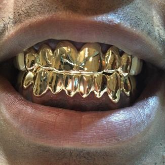 Foto da capa: Grillz de Bronze