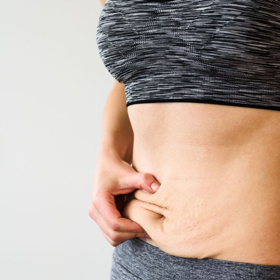 Q+A - How Do I Manage Excess Skin After Weight Loss?